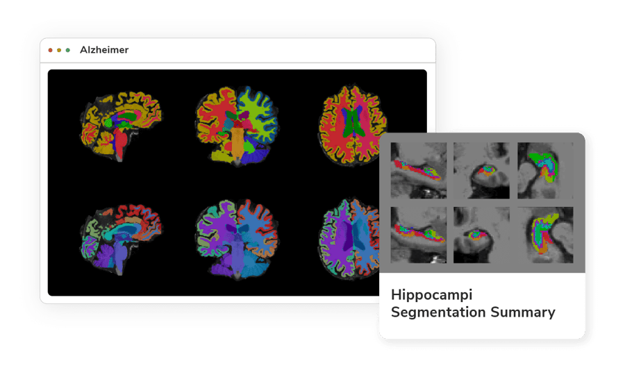 Cutting-edge Neuroimaging Biomarkers for Alzheimer Research