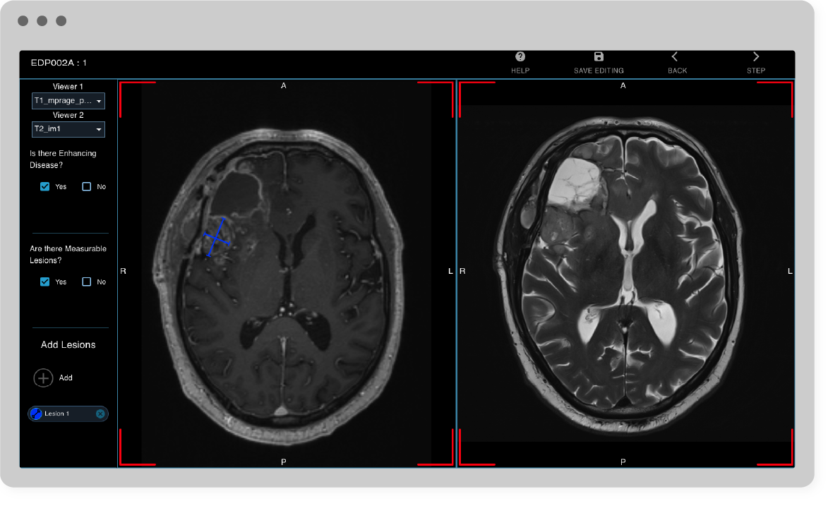 AI Neuroimaging Diseases Packages