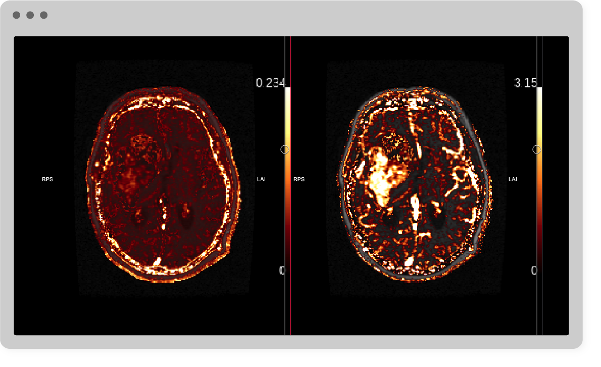 AI Neuroimaging Diseases Packages