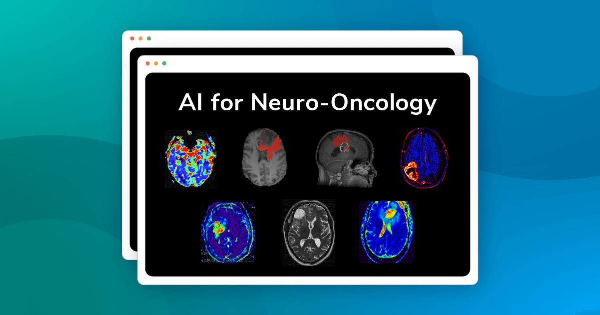 Advanced Neuroimaging Biomarkers For Brain Oncology