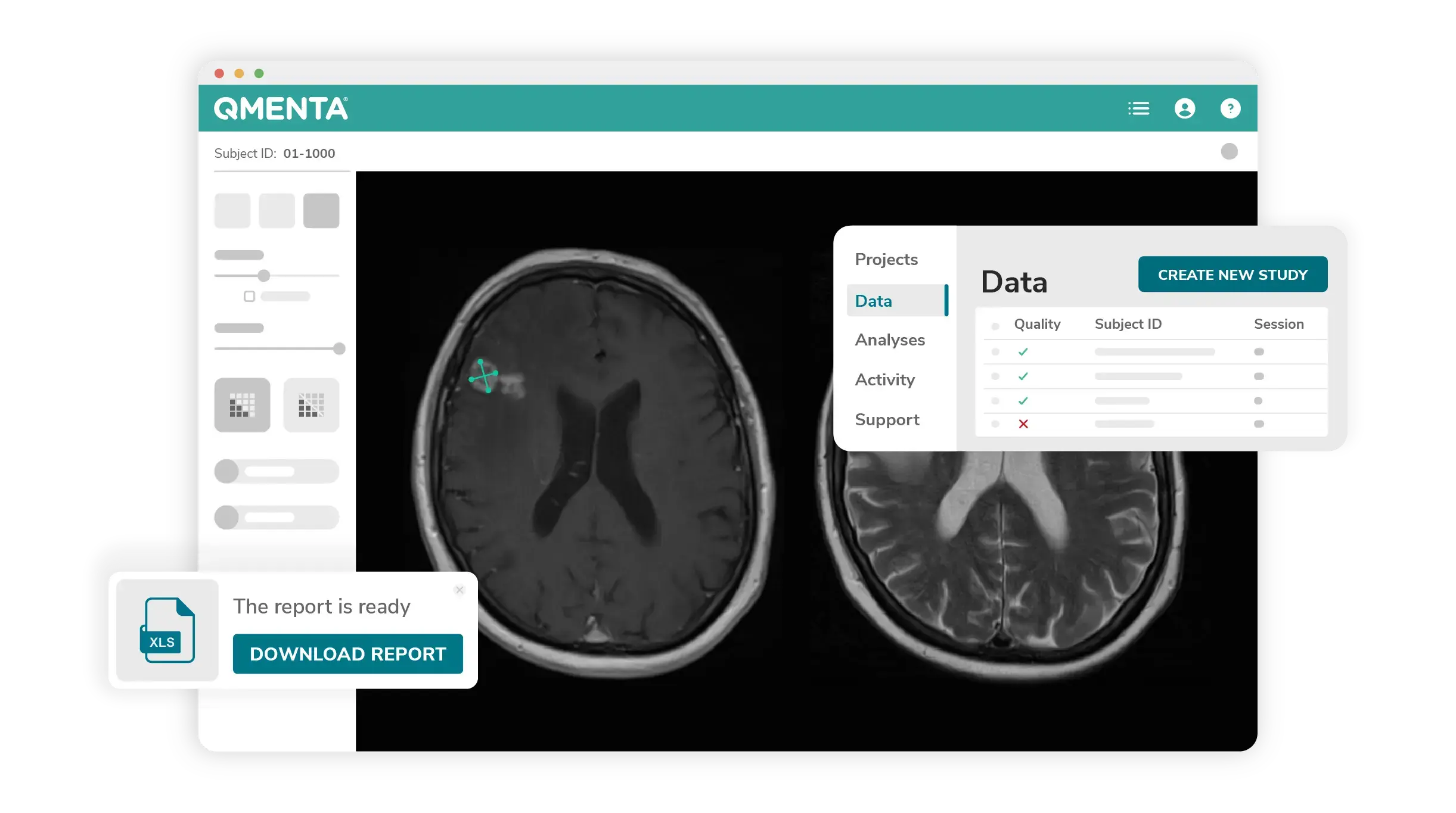 User-interface-QMENTA-Brain-Analysis